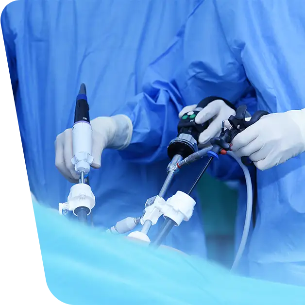 VenArt - What is and how is a laparoscopic surgical intervention carried out
