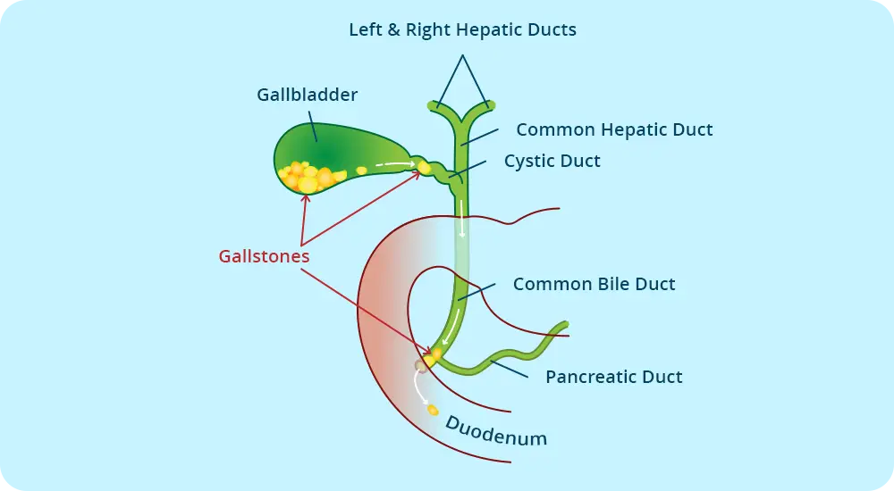 The cholecyst (gallbladder) is a pear-shaped organ, located below the liver, which stores bile and participates in digestion.