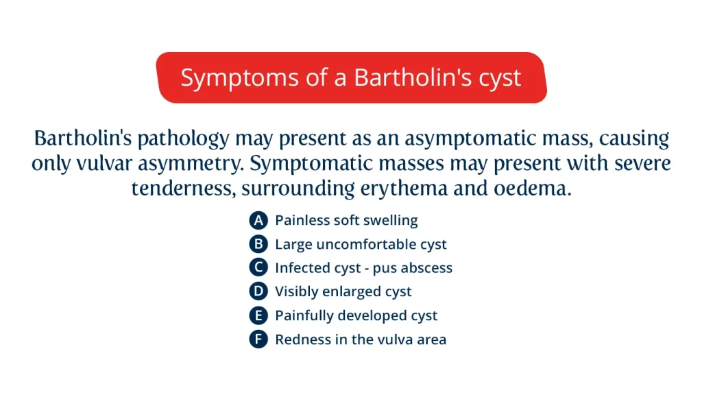 symptoms specific to the development of a Bartholin's gland cyst