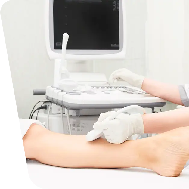 Vascular Doppler ultrasound for the lower limbs